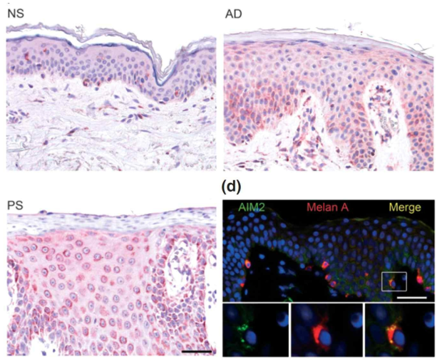 De Koning et al Exp Dermatol 2012