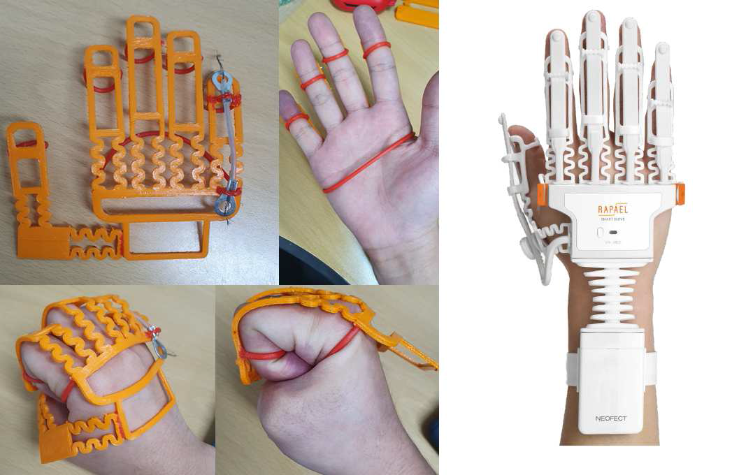 3D프린팅으로 제작된 웨어러블 글러브 (우)상용 웨어러블 글러브 (출처 : 네오펙트)