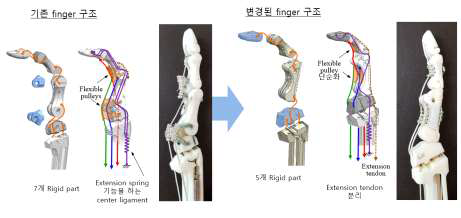 손가락 관절 구조의 개선