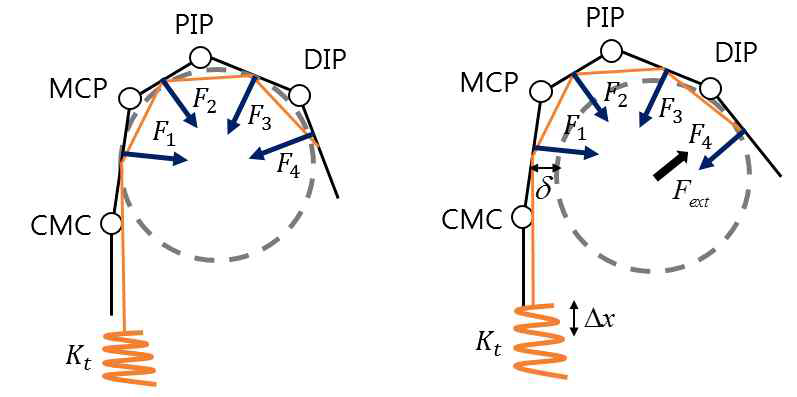 부족구동의 손가락의 관절 움직임 모델링 모식도