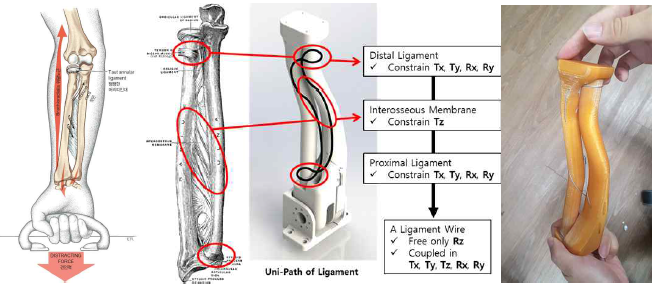 인체 요척골 구조와 인대 구조를 모사설계한 와이어-터널 고정 구조