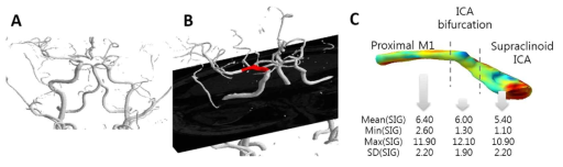 MRI TOF 상의 signal intensity gradient 분석을 통한 기저 혈관의 혈관전단응력 패턴 분석