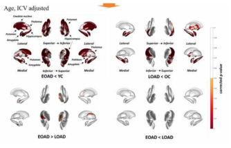 Group간 subcortical structure shape 비교