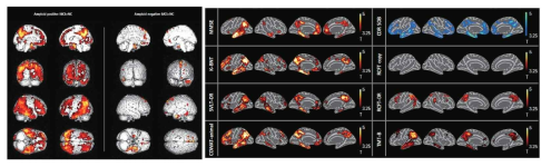 amyloid positive MCI 및 amyloid negative MCI group과 NC group과의 THK5351 retention 비교(왼쪽) 및 MCI group 내에서의 신경심리검사와 THK5351 retention의 correlation