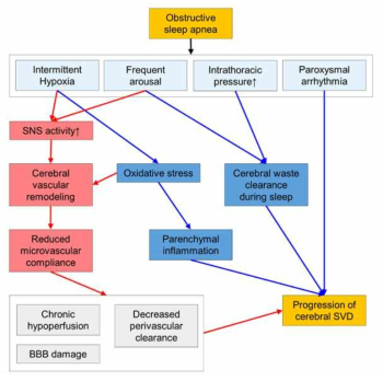 수면무호흡증과 대뇌 소혈관질환 발생과의 관계. 소혈관변성에 의존 (붉은 색) 및 소혈관변성과 독립적인 (파란색) 기전이 공존할 수 있음