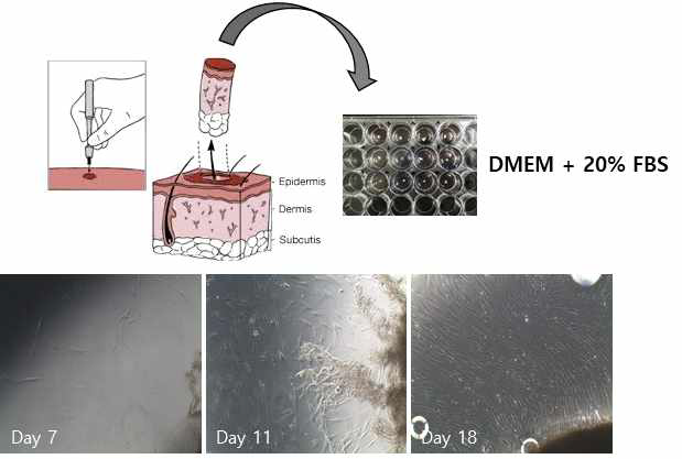 AD 환자 skin punch biopsy 조각에서 피부섬유아세포 추출 및 배양 과정