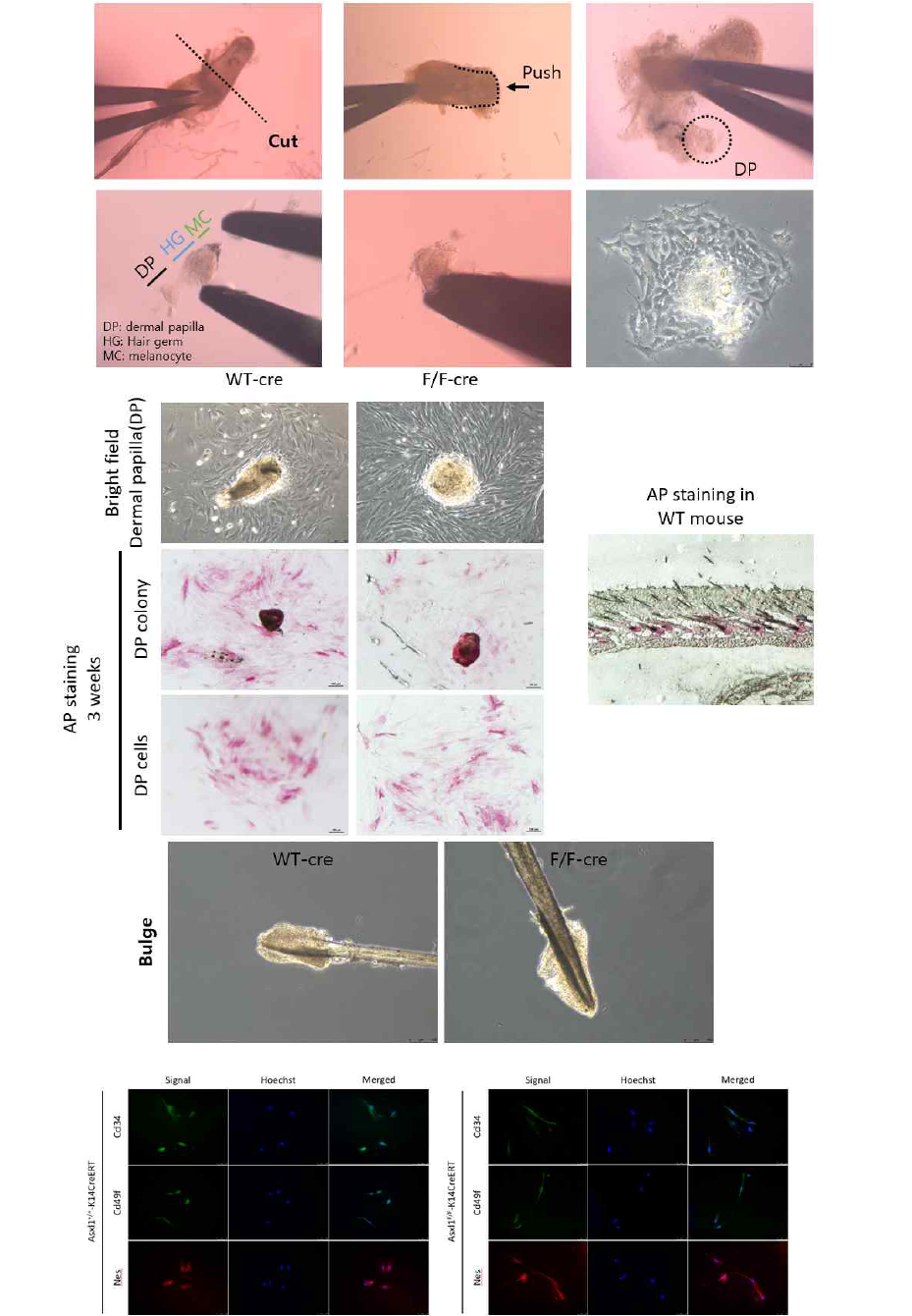 Asxl1 cKO vibrissae에서 dermal papilla 세포와 bulge stem cell 세포를 분리하여 마커를 통한 세포 확립 결과