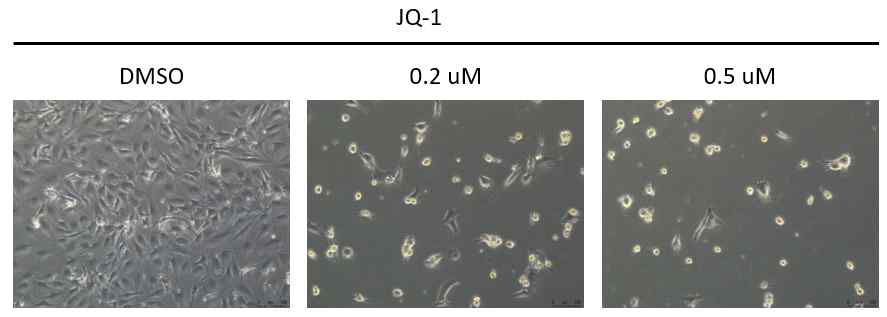 모낭줄기세포에 JQ-1 농도별 처리에 따른 세포 사멸함