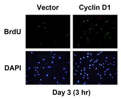 Cyclin D1이 발현하는 모낭줄기세포에서의 BrdU에 대한 immunocytochemistry