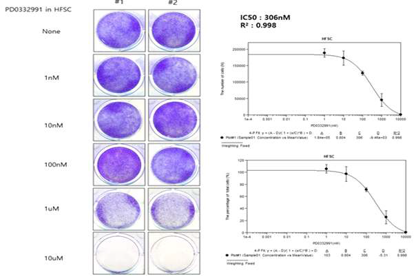 PD0332991에 의한 모낭줄기세포 콜로니 형성능 억제 효과