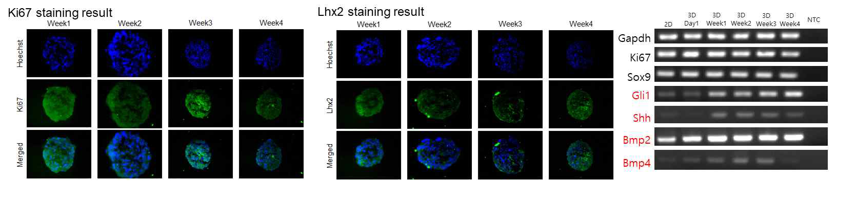 모낭줄기세포 3차원 세포구상체의 염색결과 및 성장기 단계 마커 발현
