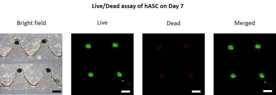 hASC 스페로이드의 live/dead 실험 결과 사진