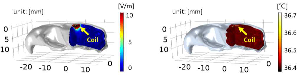 슈퍼컴퓨팅 자원을 활용한 3차원 시뮬레이션을 통하여 예상한 랫트 뇌 부위에서의 전기장 및 발열 분포를 예측할 수 있는 모델