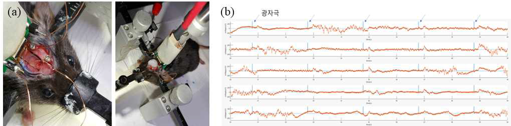 (a) 뇌정위 수술과 더불어 전극을 통한 뇌 신호 측정 중인 실험, (b) 광자극에 의해 발생하는 시각 피질 영역의 전기 신호 측정 결과