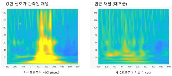 Wavelet 분석으로 탐지한 광자극에 의한 시각 피질에서 감마 영역의 신호 발생