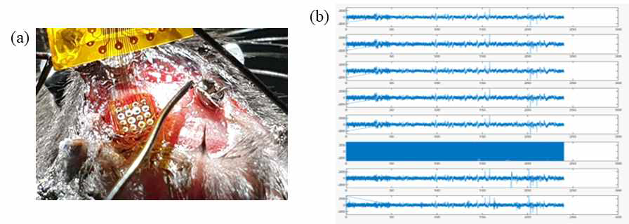 즉각적 16 channel array 수술 실험과정. (b) 실험결과 (X축 : seconds, Y축 :µV)