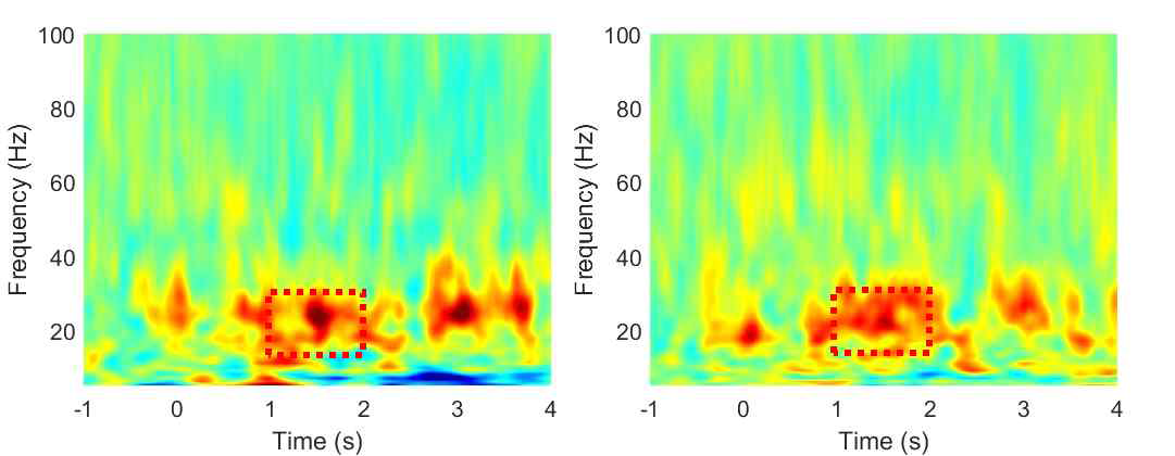 체성감각 영역 전극에서의 감각 구분 특이적 뇌반응 Time-Frequency 맵 정답시(왼쪽)/오답시(오른쪽)