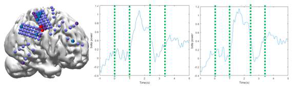 (좌) 촉감각 작업기억 해당 영역 (중,우) 영역에서의 Beta wave