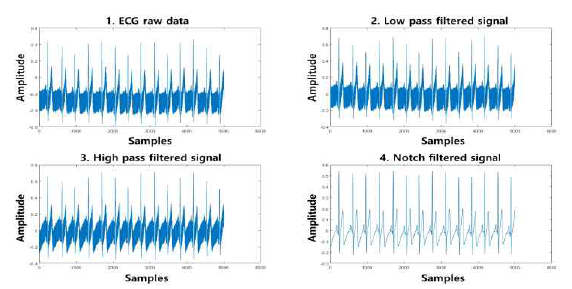 심전도 신호처리 과정