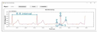 심전도 데이터 모니터링 및 수집 어플리케이션