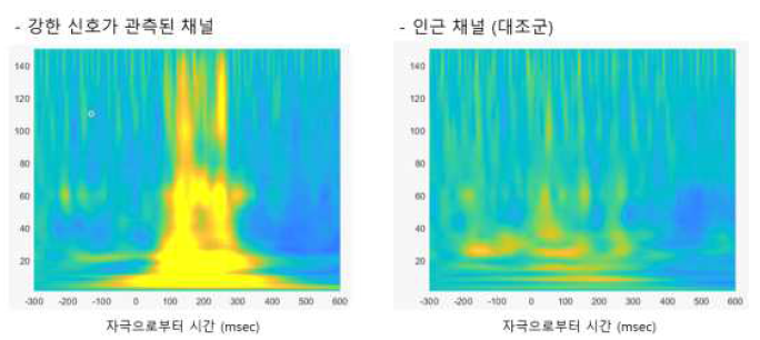 Wavelet 분석으로 탐지해 낸 광자극에 의해 시각 피질에서 감마 영역의 신호 발생