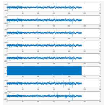 즉각적 16 channel array 수술 실험결과 (X축 : seconds, Y축 :μV)