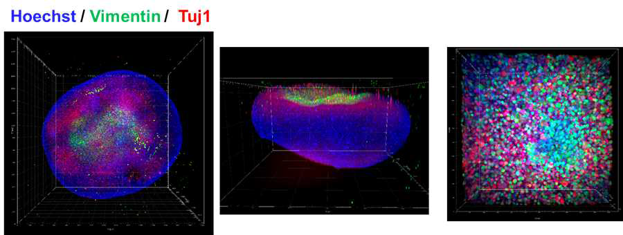 오가노이드 3D 형광현미경 사진과 중심 부위의 단면 확대 사진 (우측)