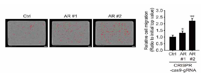 AR 결핍에 따른 LNCaP 세포 이동능 증가