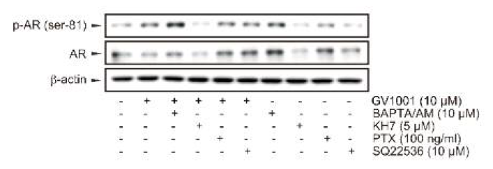GV1001의 AR 활성화를 매개하는 G-단백질 신호 평가