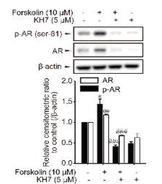 KH7 처치에 의한 forskolin-유도 AR 활성화 억제 효과