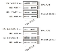 GV1001 처치에 의한 AR 결합 단백질 분석