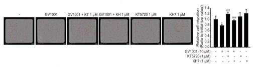 Gas-cAMP를 경유하는 GV1001의 LNCaP 세포주 이동능 억제 효과