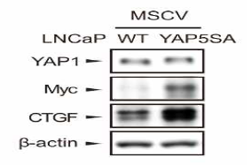 YAP1 활성화 형태인 YAP5SA 발현 LNCaP 세포 구축