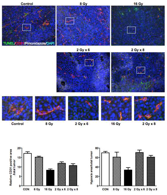 종양의 저산소환경과 종양혈관내피세포의 방사선 민감도 영향 규명을 위해 종양조직에 면역조직화학염색기법을 통해 pimonidazole (저산소환경표지자), CD31 (혈관내피세포표지자), TUNEL (세포사멸표지자)를 동시에 염색함
