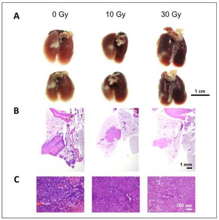 방사선 치료 후 4주째 각 폐암실험군의 (A) 육안사진, (B) hematoxylin & esoin으로 염색한 폐조직 사진