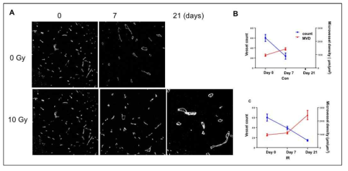 환자유래 glioma stem like cell를 뇌내에 주입하여 형성한 정위뇌암에 방사선을 조사하고 방사선 조사 유무에 따른 종양 크기별 종양 내 혈관변화 분석