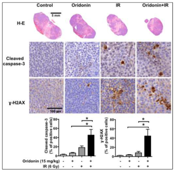 Oridonin에 의한 방사선 민감도 영향 규명을 위한 종양 조직 분석