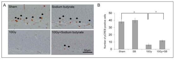 뇌암조직환경 방사선 민감도 조절제 후보 sodium butyrate의 정상 뇌조직 방사선 민감도 평가
