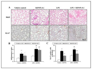 SiONP의 폐독성 및 염증 영향 평가 (A) 조직분석, (B) 염증분석, (C) 폐세포 증식마커 분석