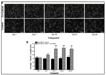 Effect of endothelial cells on angiogenic activity of cancer cells