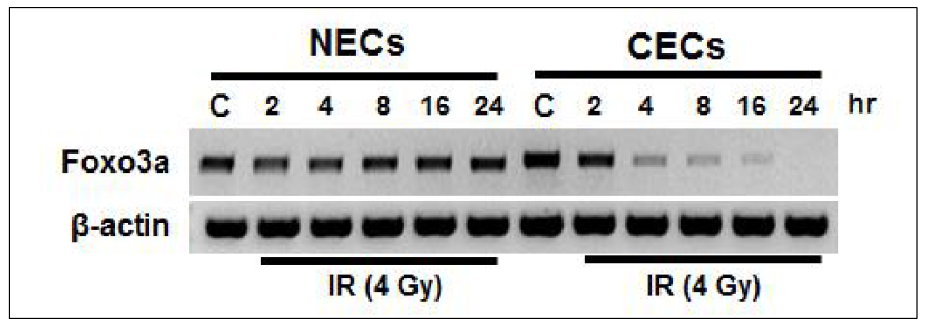 Expression of Foxo3a in radiation treated normal and cancer endothelial cells isolated from human breast cancer tissues under hypoxia