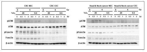 Expression of proteins related to radiosensitivity of cells in radiation-treated normal and cancer endothelial cells isolated from human colorectal cancer tissues and human head & neck cancer tissue under normoxia and hypoxia