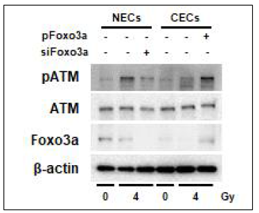 Effect of Foxo3a expression on activation of ATM in irradiated normal and cancer endothelial cells isolated from colorectal cancer tissues