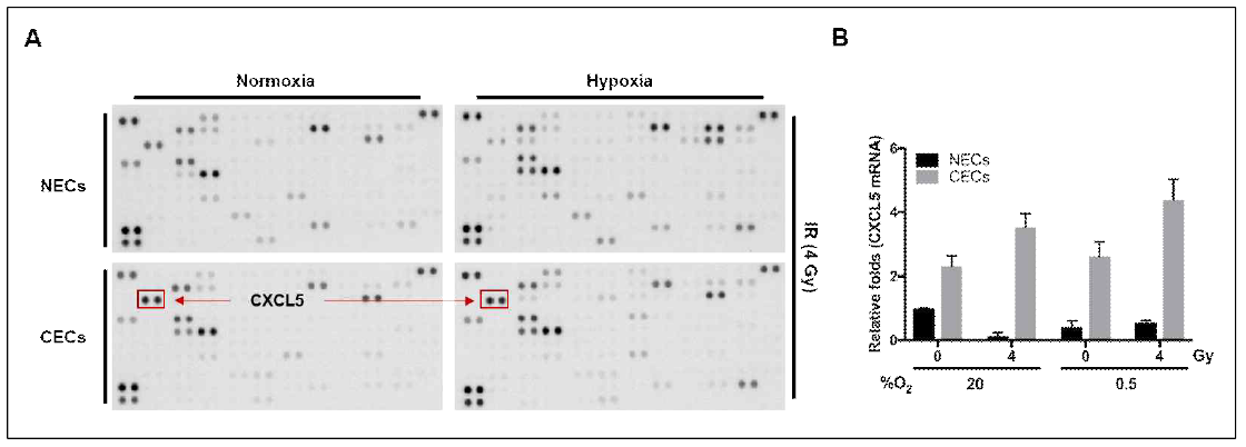 Secretion and expression of CXCL5 in normal (NECs) and cancer (CECs) endothelial cells isolated from colorectal cancer tissues treated with or without radiation (4 Gy) under normoxia and hypoxia