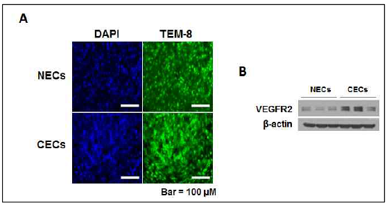 Expression of endothelial cell makers between normal anc cancer endothelial cells isolated from human breast cancer tissues