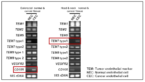 Expression of endothelial cell makers between normal anc cancer endothelial cells isolated from human breast cancer tissues