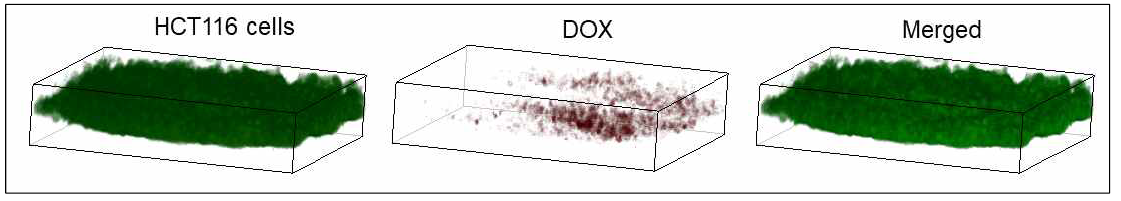 Analysis of utilization of PCL fiber culture system for individual patient treatment. indicates TRITC-phalloidin-labelled cancer cells