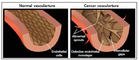 Abnormality of cancer vasculature