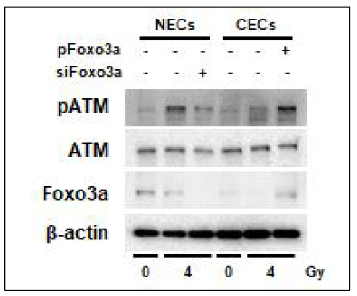 Effect of Foxo3a expression on activation of ATM in irradiated normal and cancer endothelial cells isolated from colorectal cancer tissues