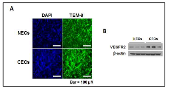 Expression of endothelial cell makers between normal anc cancer endothelial cells isolated from human breast cancer tissues